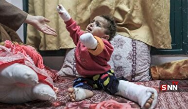 قطع عضو ۶ هزار تن از مردم فلسطین در حملات رژیم صهیونیستی به غزه