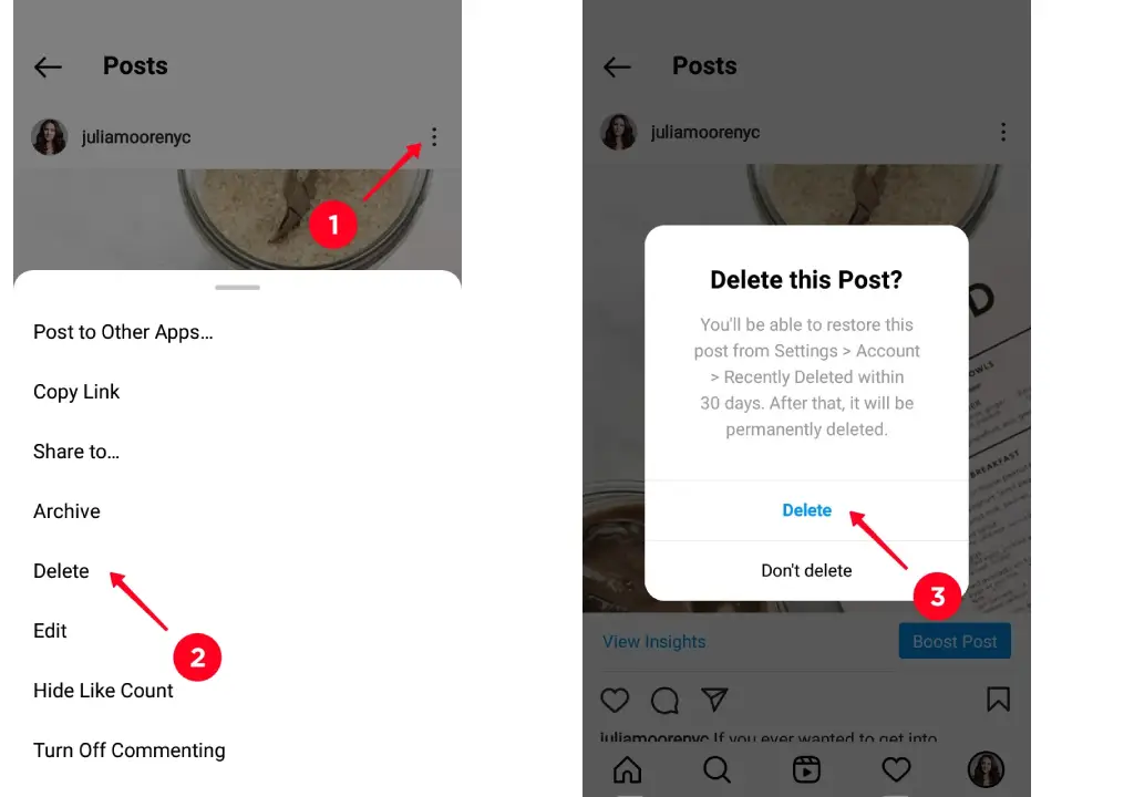 حذف پست ایستا